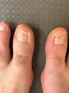 MyUglyFeetAUS profile picture